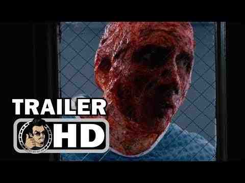 Inoperable - trailer 1