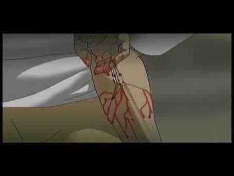 Technotise - Edit i ja - Trailer